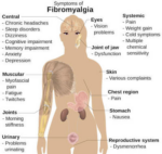 Fibromyalgia Cure