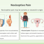 Nociceptive Pain